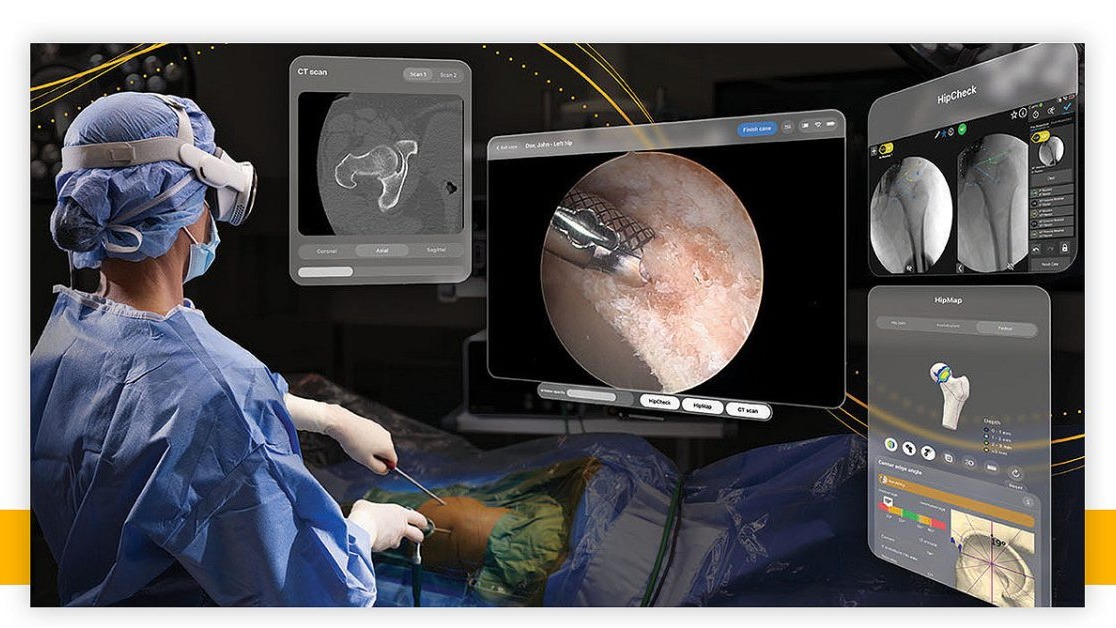 Apple Vision Pro